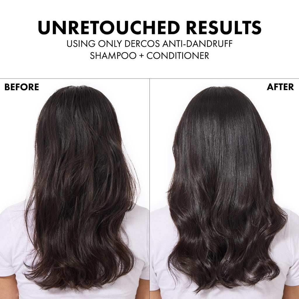 Vichy Dercos Anti-Pelliculaire Dandruff 390 ml
