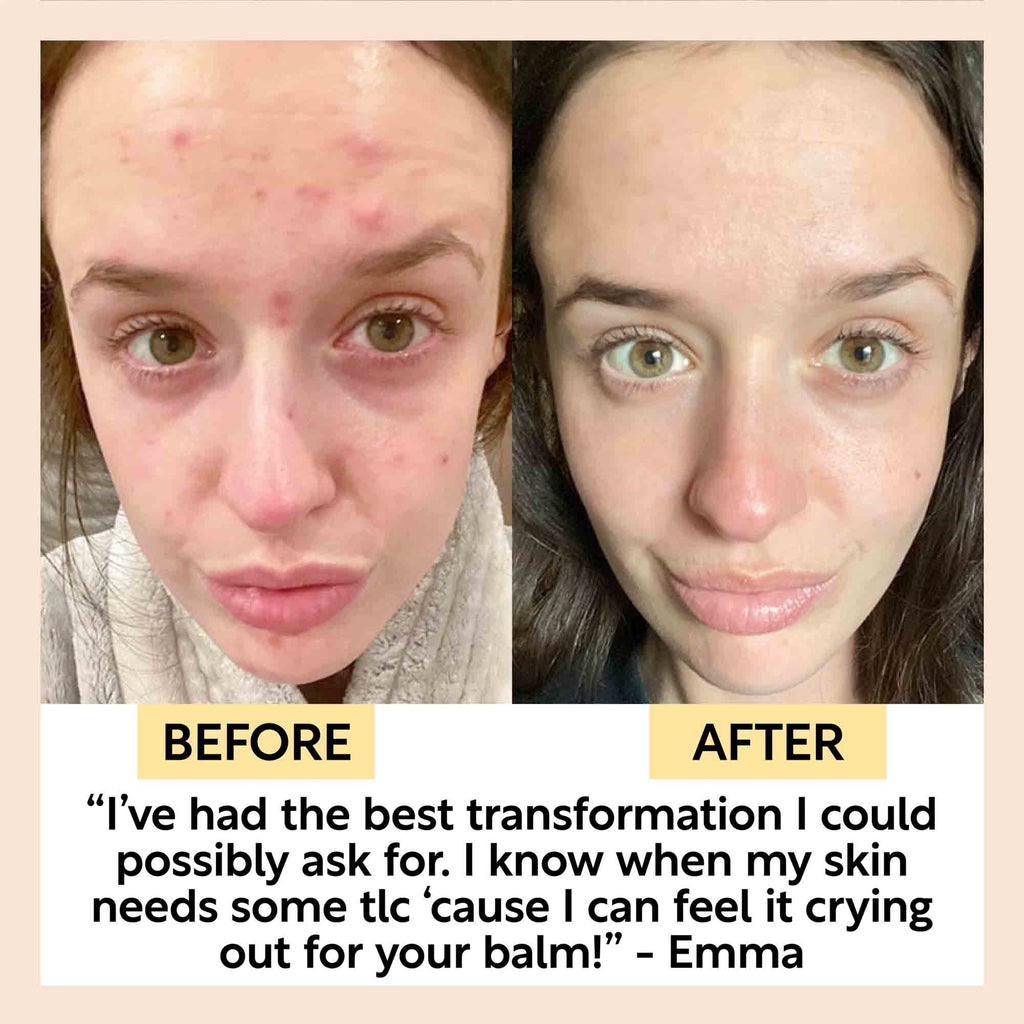 UpCircle Cleansing Face Balm — Travel Size