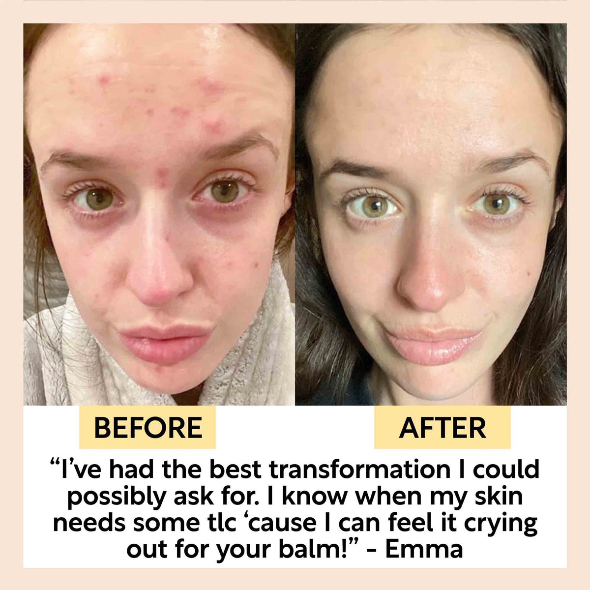 UpCircle Cleansing Face Balm — Travel Size