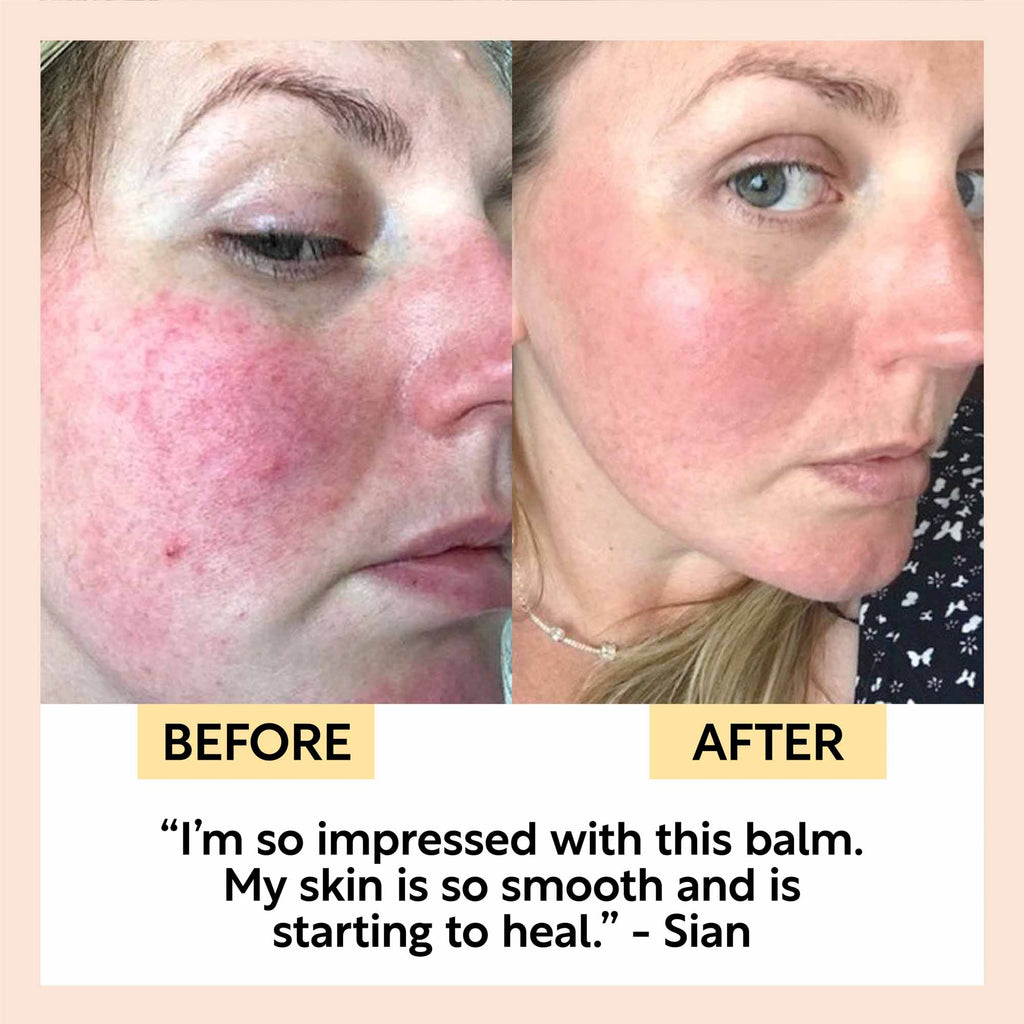 UpCircle Cleansing Face Balm — Travel Size