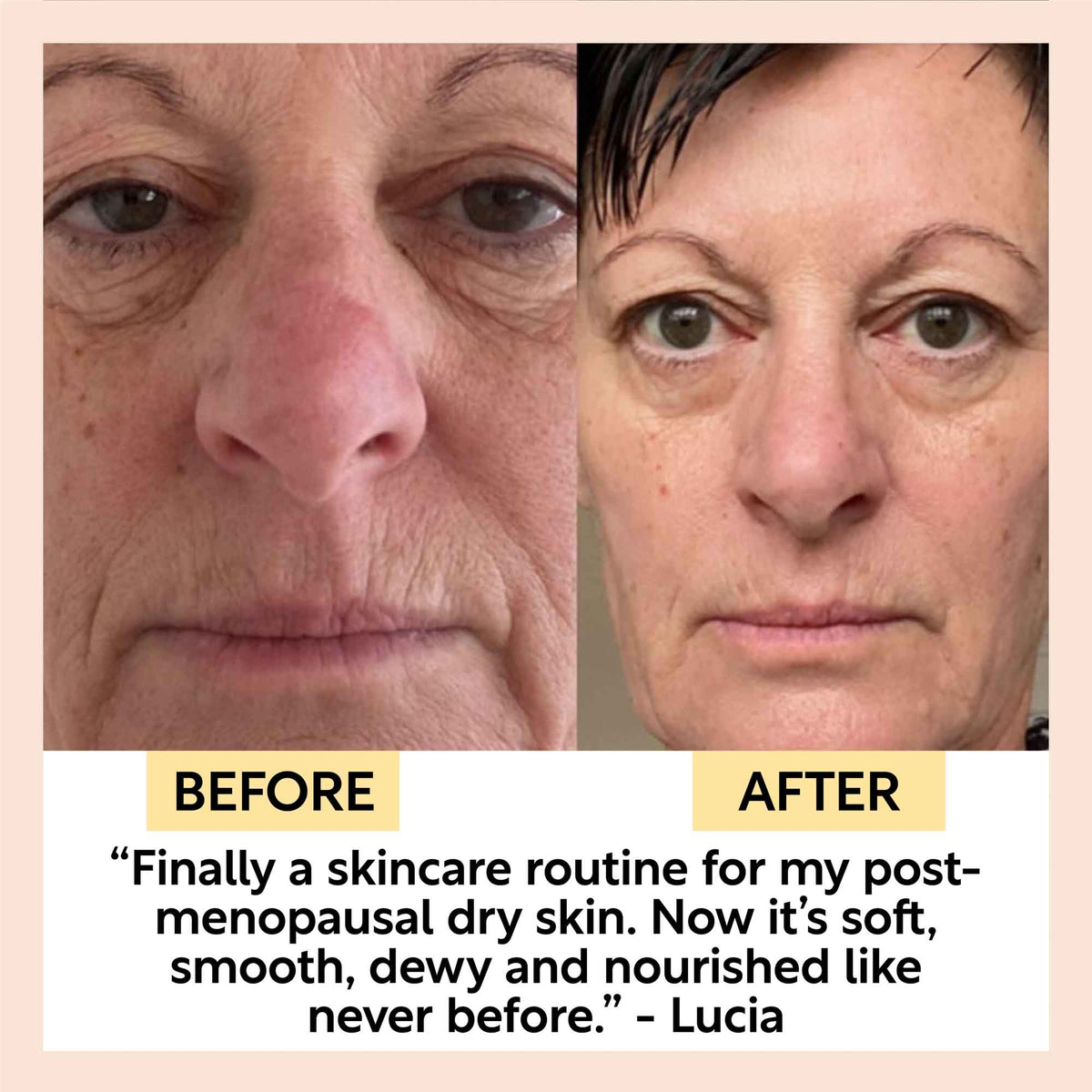 UpCircle Complete Skincare Bundle — 6 Pieces