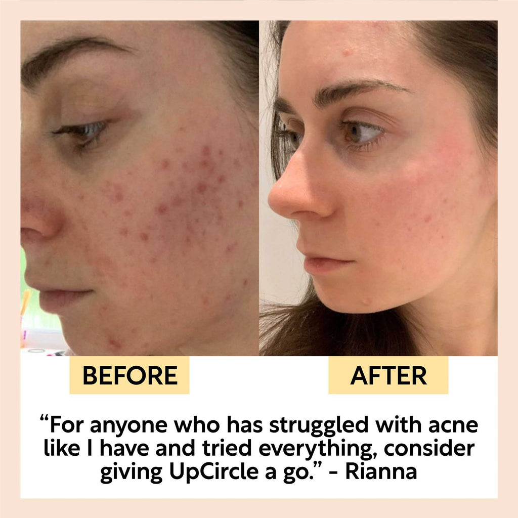 UpCircle Cleanse, Tone & Moisturize Set