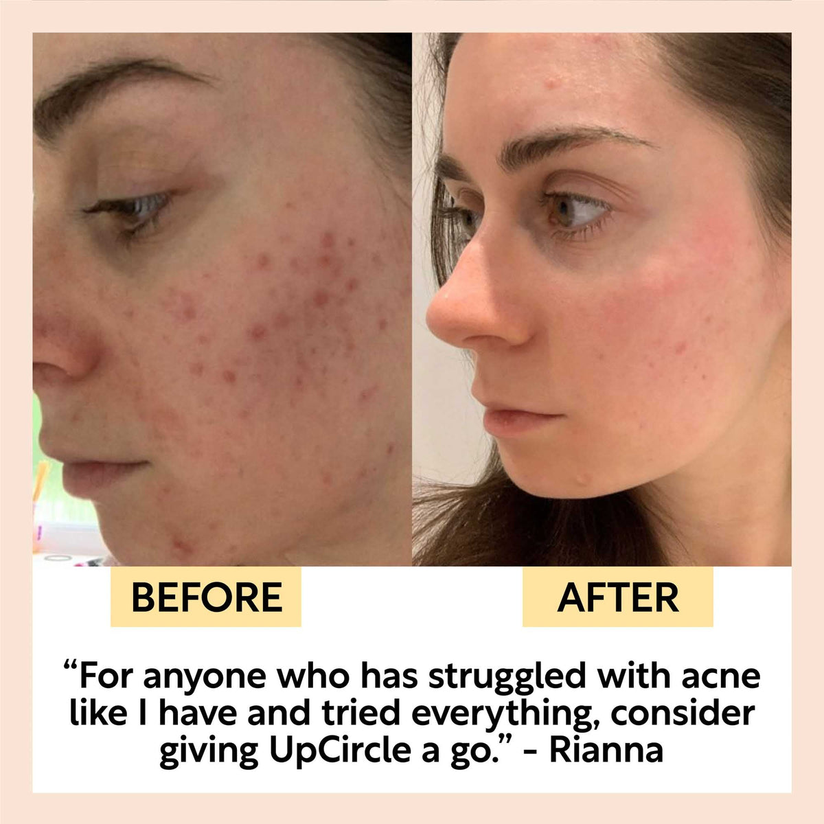 UpCircle Cleanse, Tone & Moisturize Set