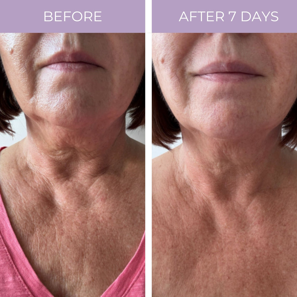 Ageless Throat & Decolletage Anti-Aging Neck Creme