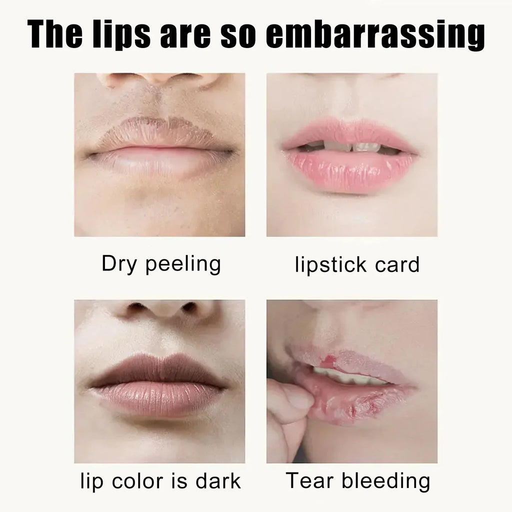 EELHOE Cherry Nourishing Lip Mask Fade Lip Lines Improve Dry Repair Cracks Smoothing Lip Patches Moisturizing Skincare Mask 5pcs