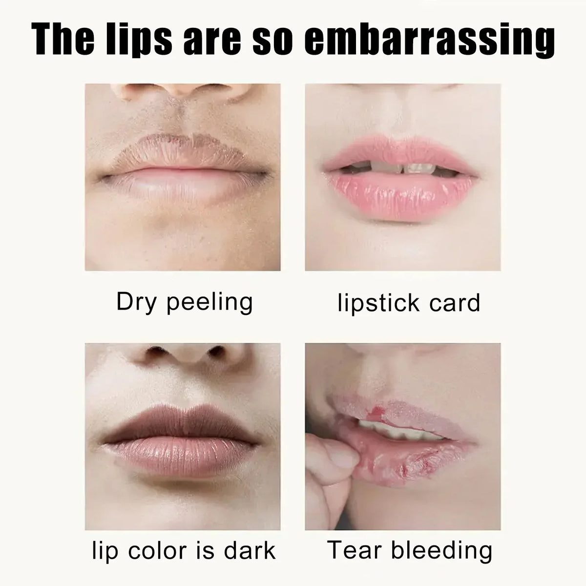 EELHOE Cherry Nourishing Lip Mask Fade Lip Lines Improve Dry Repair Cracks Smoothing Lip Patches Moisturizing Skincare Mask 5pcs