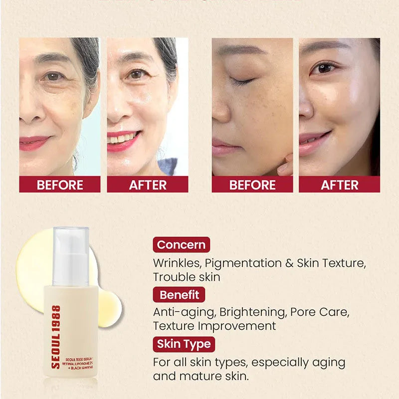 1/2PCS Korean SEOUL 1988 Retinol Face Serum Fade Fine Wrinkle Moisturizing Whitening Remove Spots Shrink Pores Beauty Skin Care
